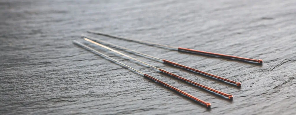 Acupuncture_for_Chronic_Pain_Everything_You_Need_to_Know.